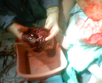 afterbirth, placenta, dinner? no thanks.. looks like liver..